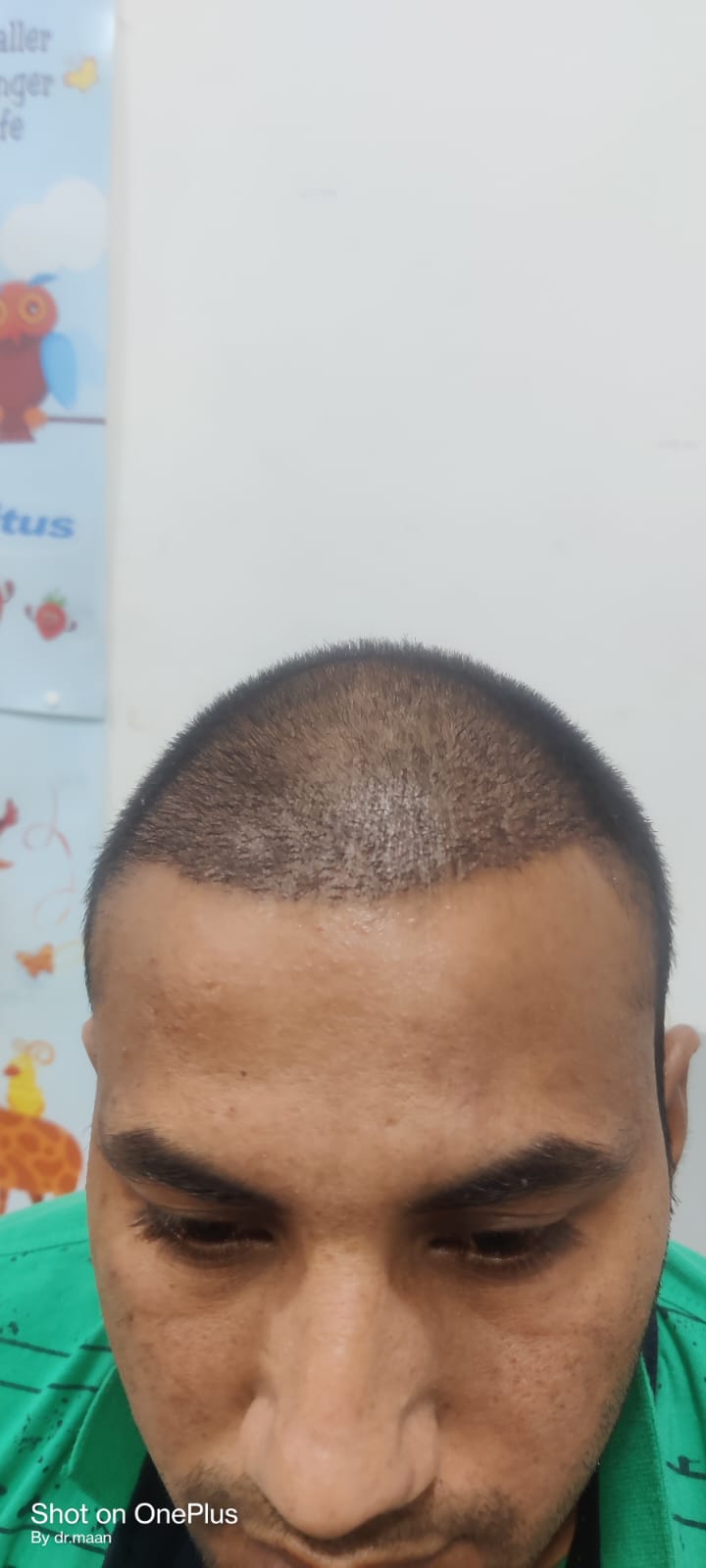 Before / After